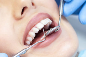 Mersin Periodontoloji Diş Eti Tedavisi